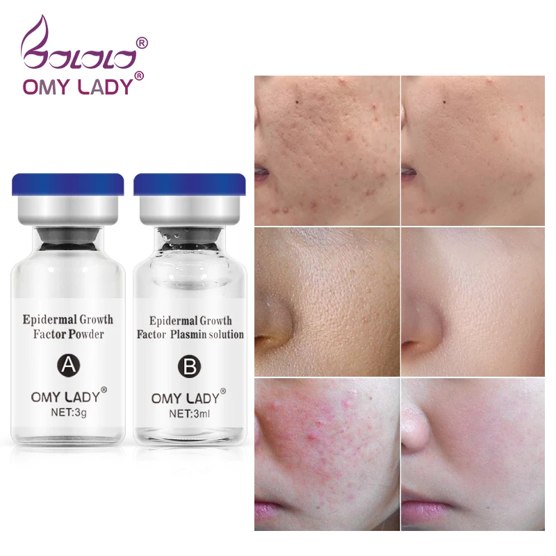 Omylady Skin Rejuvenation Serum Acne Treatment Repair Factor Lyophilized Powder Face Skin Care Ageless Serum Face Cream Day Creams Moisturizers Aliexpress