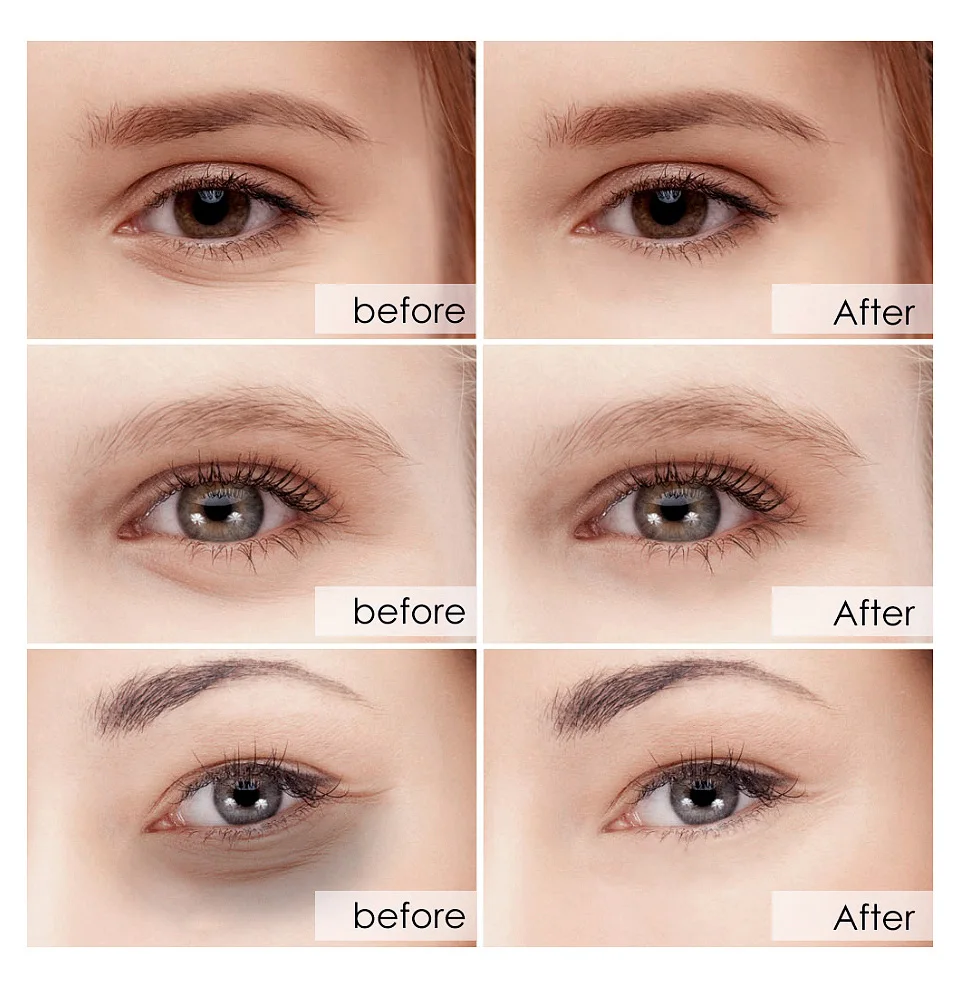 VIBRANT GLAMOUR Eye Mask Moisturizing Hyaluronic Acid Eye Patch Skin Care Collagen Anti Aging Gel Remove Dark Circles Eye Bag