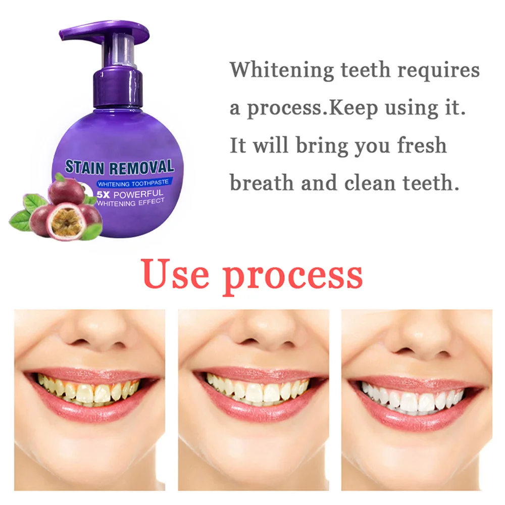 Пресс Зубная паста удаление пятен отбеливание зубная паста пятновыводитель гигиена полости рта уход