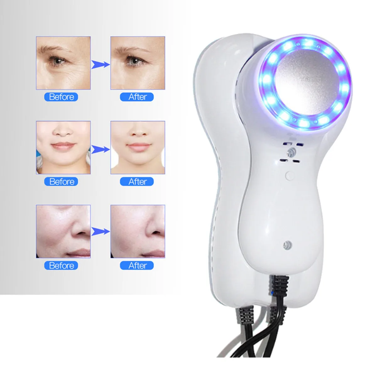  Cold Hammer Blue LED Photon Cell Activating Firming Skin Therapy Massager Shrink Pores Remove Acne 