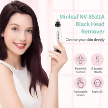 Электрический угорь поры, акне чистую поверхность прибор красота Очищение лица инструмент угри, прыщи прибор для удаления черных точек удаление черных точек