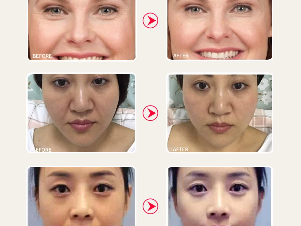 H6331ccc78d2a453e9669120c85e1bf47t SOMILD Korean SkinCare Set Treatment Detox Bubble Mask Anti Aging Wrinkle Remove Face Cream Whitening Moisturizing Facial Lotion