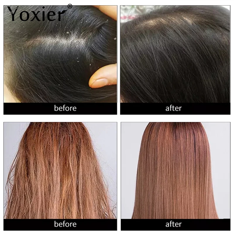 Yoxier New Hair Growth Essence Oil Effective Extract Anti Nourish Hair Roots Treatment Preventing Hair Loss 5