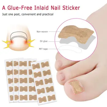 

1/5pc Non-Glue Toenail Patch Ingrown Toenail Correction Pedicure Tool Toe Inlay Nail Corrector Nail Patch Correction Stickers