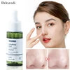 Nose Blackhead Remover Face Serum Shrink Pores Essence Oil-Control Deep Cleaning T Zone Pore Mild Soothing Moisturizer Skin Care
