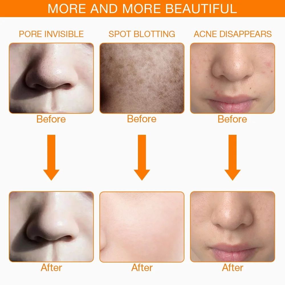 Baratos Dropshipping envío gratis fotón eléctrico LED máscara Facial máscara LED terapia de luz belleza cuidado de la piel 7 colores 3 colores mujeres