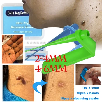 

Tag Spots Remover Tool Painless Mole Skin Dark Spot Mole Removal Face Wart Tag Freckle Skin Tag Removal Kit With Cleansing Swabs