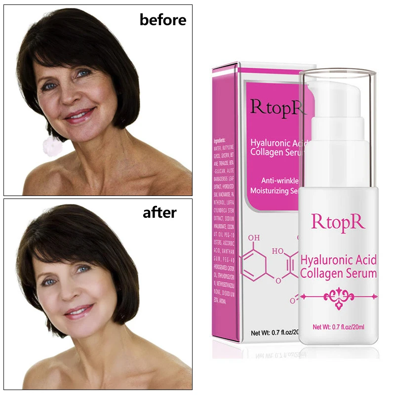

Effective Woman Hyaluronic Acid Collagen Serum Acne Treatment Anti Wrinkle Skin Essence Face Care Whitening Moisturizer Lotion