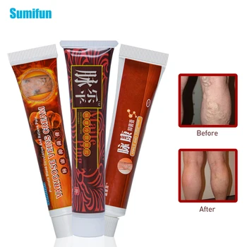 

Sumifun 2020 New Varicose Veins Treatment Cream 3 Types of 100% Original Vasculitis Phlebitis Spider Pain Relief Ointment 1Pcs