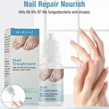 Жидкое масло для восстановления грибка ногтей, натуральное масло, Лечение ногтей, анти-удаление, онихомикоз, грибок для пальцев ног, питательный, осветляет ногти