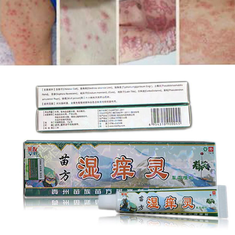 100 Natural Chinese Medicine Herbal Anti Bacteria Cream Psoriasis