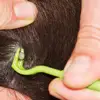 NEW 3PCS Pet Flea Remover Tool Plastic Scratching Hook Remover Pet Cat Dog Grooming Supplies Tick Removal Tool Tweezers Comb ► Photo 3/6