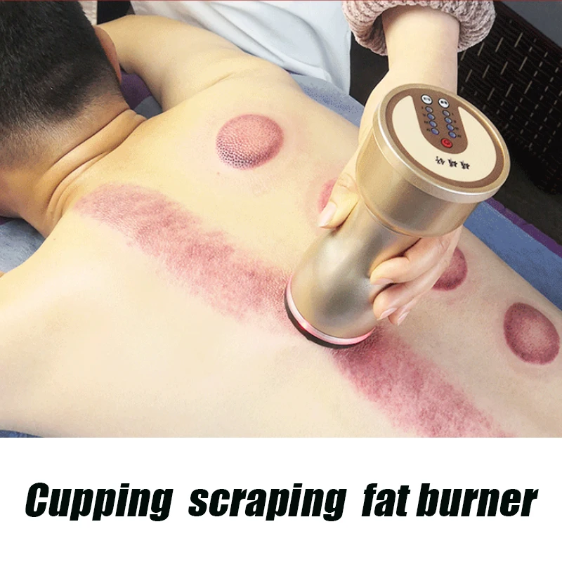 

Electric Vacuum Massager Body Suction Cup Vacuum Cupping LCD Display Guasha EMS Scraping IR Heating Fat Burner Slimming Back
