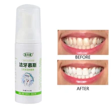 Удаление зубных пятен Зубная паста пена Очистка зубов зубная паста очистка рта бактериостатиз раствора