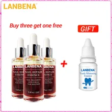 Купить 3 получить 1 подарок LANBENA для восстановления ногтей эссенция Сыворотка для лечения грибковых ногтей Удаление онихомикоза 3 шт+ Отбеливание зубов эссенция