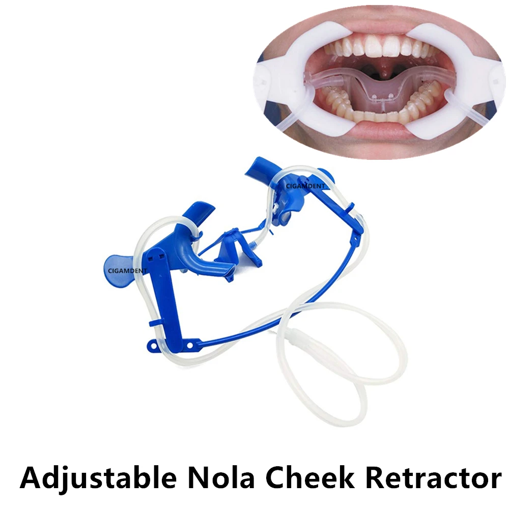 

1Set Dental Lip Cheek Retractor Nola Dry Field System Teeth Whitening Mouth Opener Suction Tubes Adjustable Orthodontic Blue