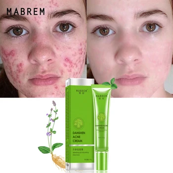 

MABREM Acne Treatment Plant Face Cream Remove Acne Scar Oil Control Shrink Pores Acne Cream Nourish Whitening Moisturizing Skin