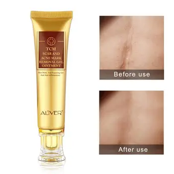 

30ml Fast Effective Acne Scar Removal Cream Skin Repair Cream Stretch Face Spots Blackhead Acne Treatment Acne Whitening Ma C5J0