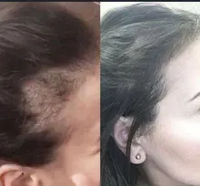 Cuidado del cabello para el crecimiento del cabello aceites esenciales esencia Original auténtico 100% pérdida de cabello líquido salud belleza suero denso para el crecimiento del cabello