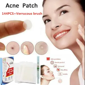 

BellyLady Skin Tag Remover Medical Remover Skin Tag Mole Genital Wart Foot Corn Remover + Acne Patch