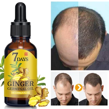 

Hair Growth Essential Oils Ginger Germinal Oil Fast Hair Growth Anti-Hair Loss Alopecia Treatment Beauty Dense Hair Growth Serum