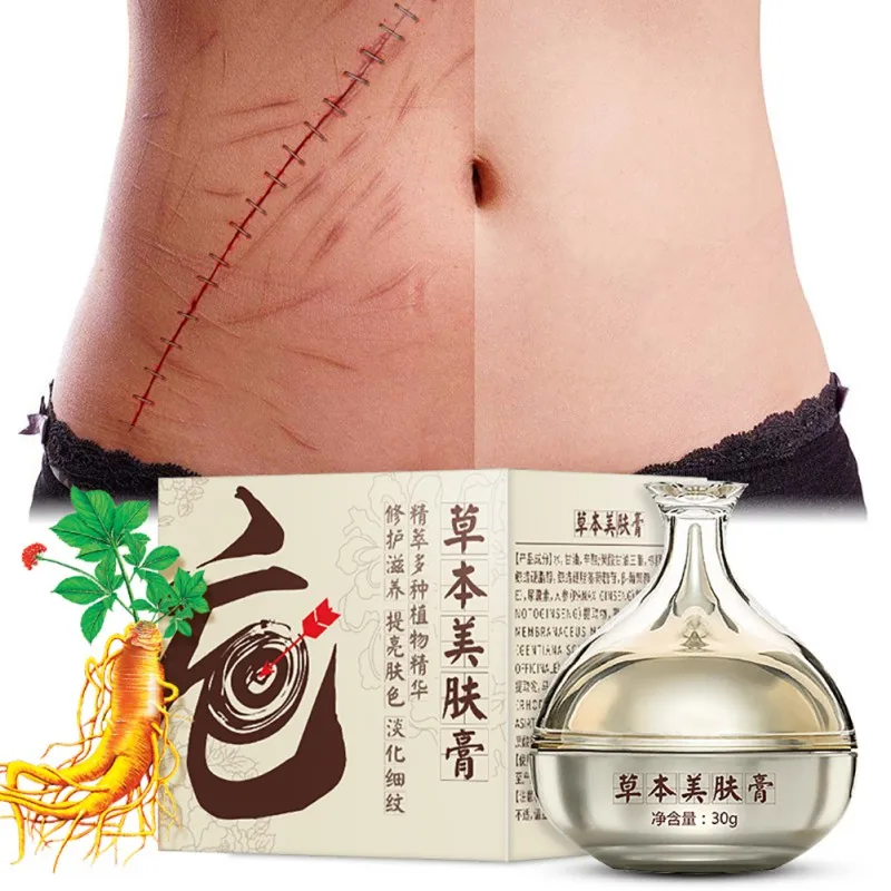 Новый рубцов уход за лицом кремы для лица удалить шрам изъян хирургическое