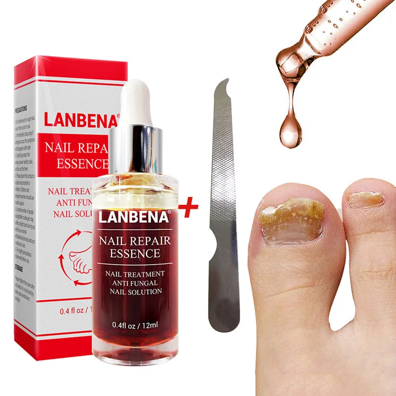  New 12ml Nail Fungal Treatment With File Anti Fungus Onychomycosis Removal Nails Care Repair Liquid