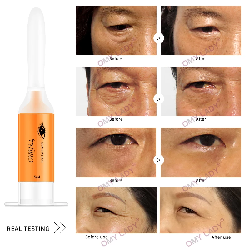 

Omy Lady Instantly Eye Cream Skin Care Anti-envelhecimento Dark Circles Anti Wrinkle Anti Age Moisturizing Firming TSLM1