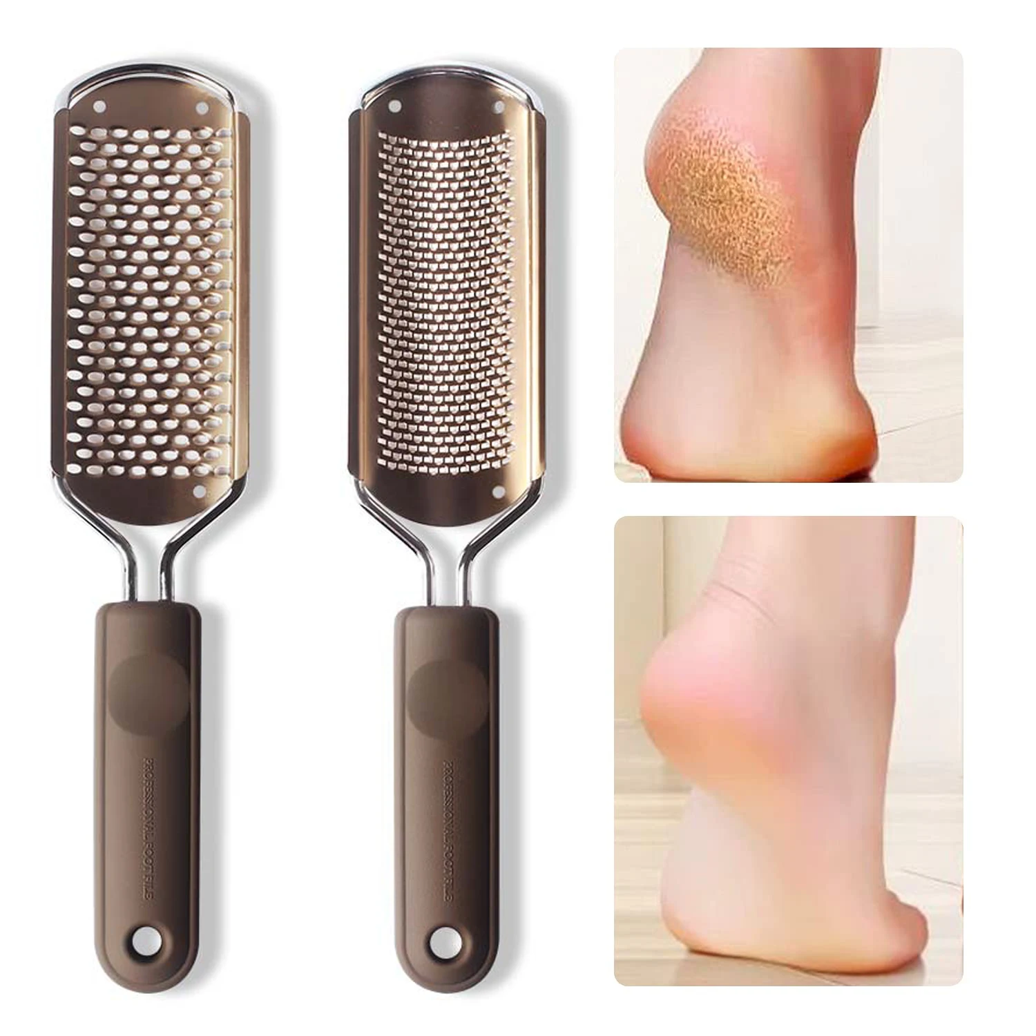 Colossal Foot Rasp Foot File and Callus Remover,Surgical Grade Stainless  Steel File to Remove Hard Skin, Foot Corn, Cracked Heels,Can be Used on  Both Wet and Dry Feet 