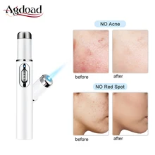 От акне лазерная ручка портативный аппарат для избавления от морщин мягкий шрам удаление синий свет терапия ручка уход за кожей лица инструмент для удаления акне