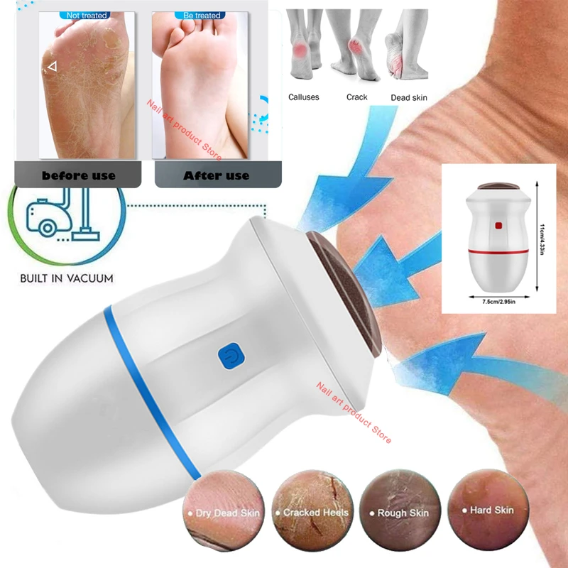 Electric Vacuum Foot Callus Remover Grinder File Machine Exfoliate Dead