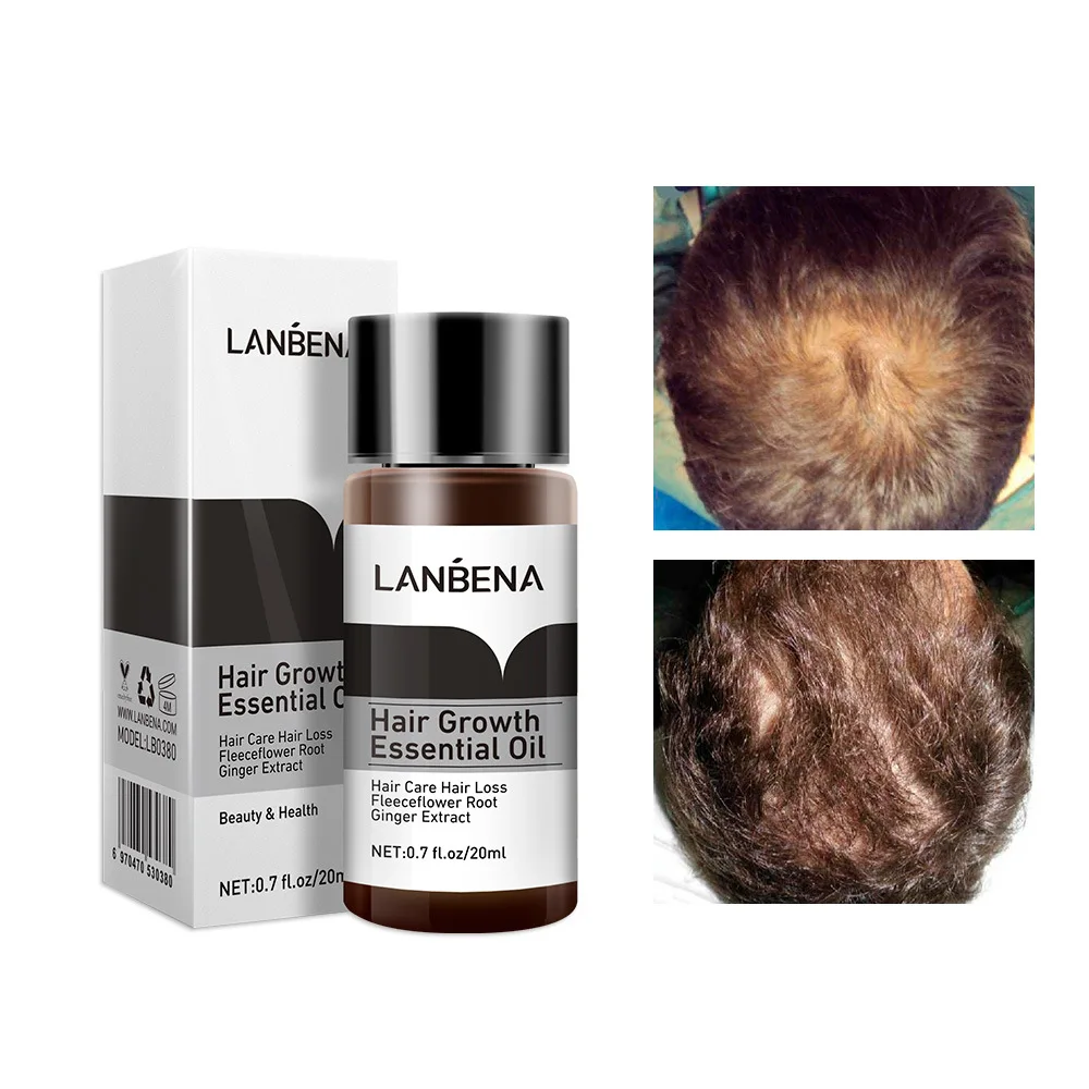 LANBENA Hair Growth Essence Products Hair Fast Powerful Essential Oil Liquid Treatment Preventing Hair Loss Hair Serum Care 20ml 20ml original korean ginger herbal serum prevent hair loss for fast hair growth restoration hair loss liquid serum hair care oil