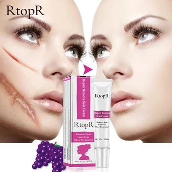 

RtopR Acne Scar Stretch Marks Remover Cream Skin Repair Face Cream Acne Spots Acne Treatment Blackhead Whitening Cream