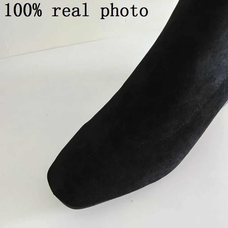 101