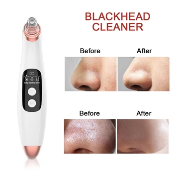 

USB Vacuum Suction Blackhead Remover Spot Acne Black Head Pimple Removal Nose Facial Pore Cleaner Beauty Face Skin Care Tools