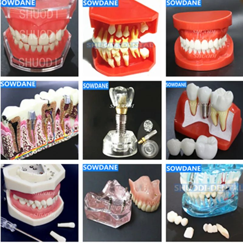  Dental Study Teaching Model Dental Standard Model Removable Teeth ADULT Children TYPODONT Model Den - 32800798284