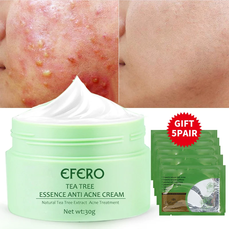 EFERO Tea Tree Essence Repair Acne Cream Anti Spots Acne Treatment Scar Blackhead Cream Shrink Pores Whitening Moisturizer Cream