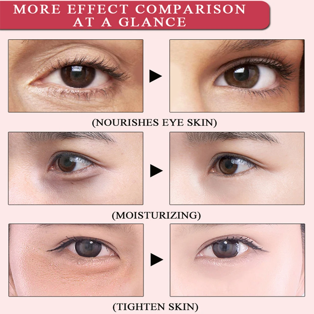 Mei Yan Qiong Black Pearl Eye Mask Moisturizing Eye Mask Anti Wrinkle Sleep Masks Remove Dark Circle Puffiness Eye Bag Anti Age