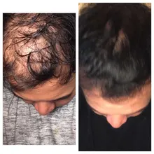 Cuidado del cabello para el crecimiento del cabello aceites esenciales esencia Original auténtico 100% pérdida de cabello líquido salud belleza suero denso para el crecimiento del cabello