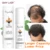 60 МЛ OMY LADY Anti Hair Loss Hair Growth Spray Эфирное Масло Жидкость Для Мужчин Женщин Сухие Волосы Регенерация Ремонт,Продукт Для Выпадения Волос