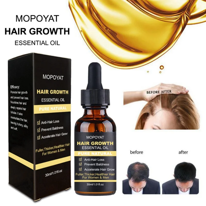 30ml Anti Hair Loss Essence Hair Growth Essential Oil Repair Damage Hair Growth Treatment Thick Root 1 30ml Anti Hair Loss Essence Hair Growth Essential Oil Repair Damage Hair Growth Treatment Thick Root 2