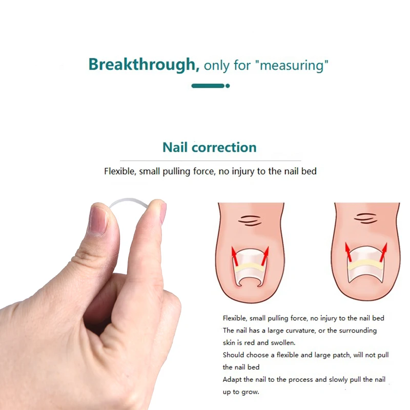 

10pcs Ingrown Toe Nail Treatment Elastic Patch Sticker Straightening Clip Brace Pedicure Tool Ingrown Toenail Correction Tool