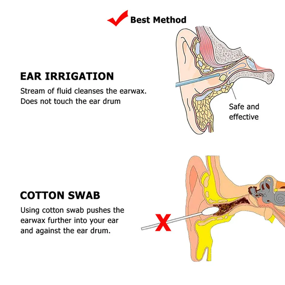 Adults & Kids Ear Irrigation Cleaning Kit Premium Quality Ear Wax Removal Kit With Ear Washing Syringe Squeeze Bulb Ear Care (9)