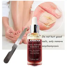 Лечение ногтей от грибка Уход за ногами и ногтями ремонт эссенция восстанавливает здоровый внешний вид обесцвечиваемых поврежденных ногтей анти-инфекция уход