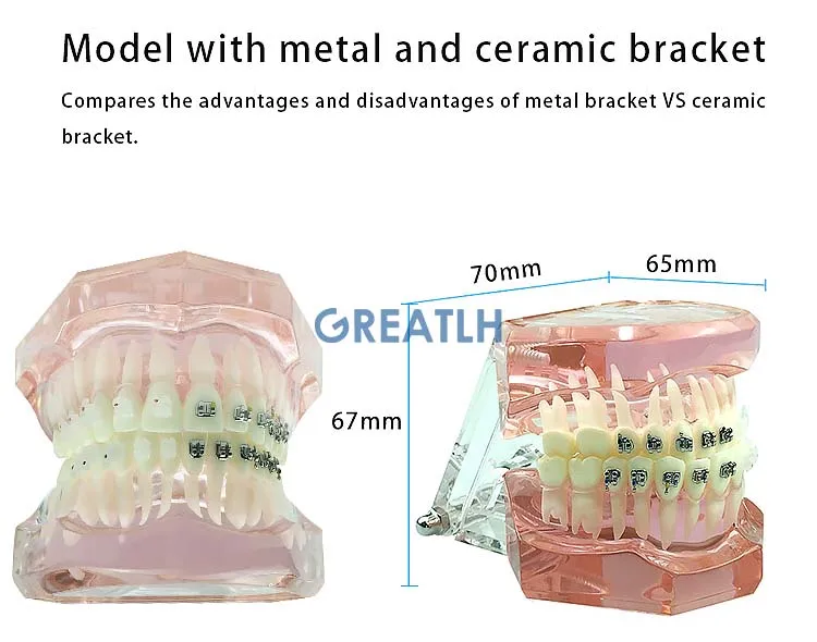 e modelo de demonstração de ensino dentário