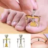 Ingrown Toenail Toe Fixer Recover Correction Device Pedicure Foot Nail Care Tool Easy to Use Инструменты по уходу за ногтями ► Photo 1/6