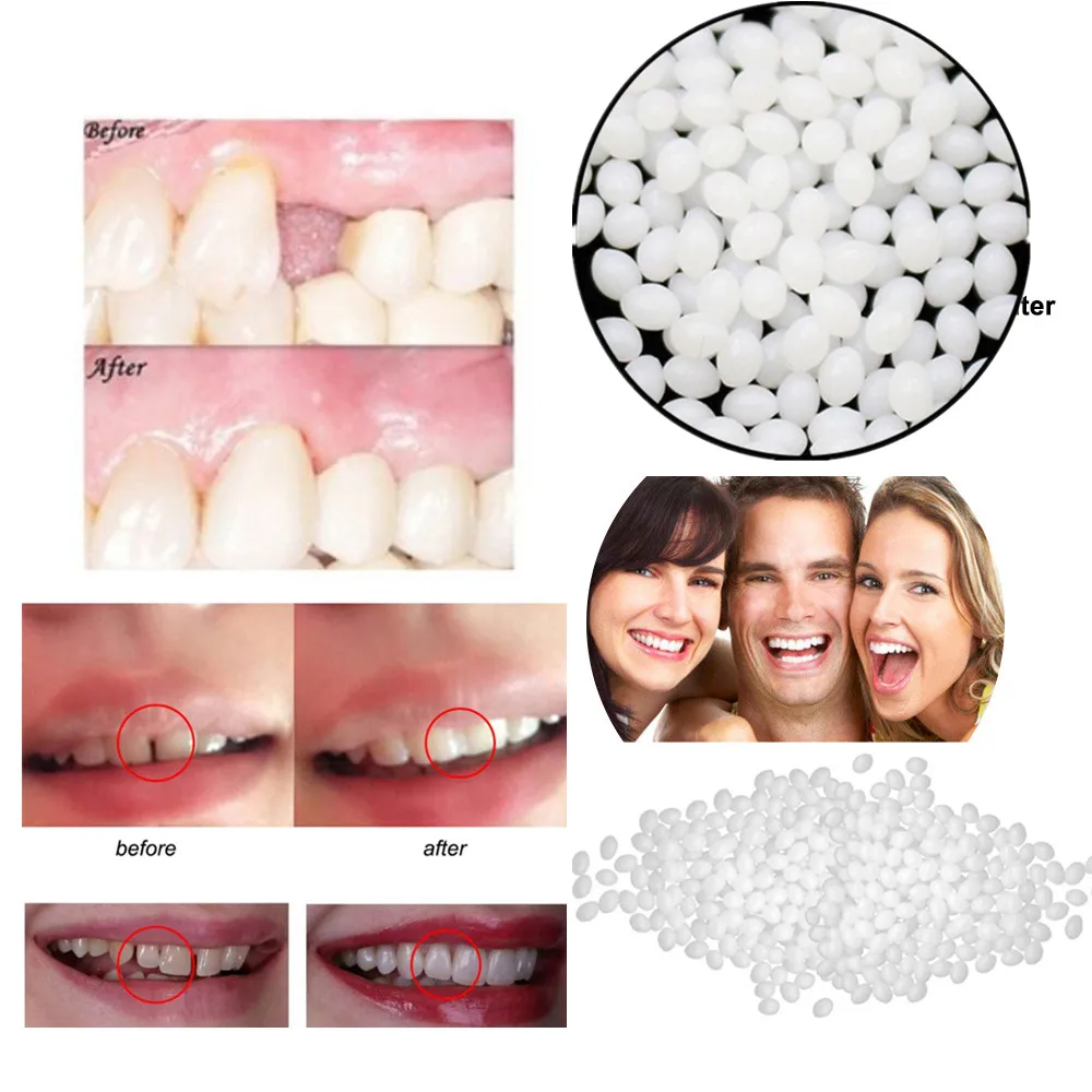 

10/50/100g Resin False Teeth Solid Glue Orthodontic Supplies Temporary Tooth Repair Denture Adhesive Teeth Dentist Teeth Gap Kit