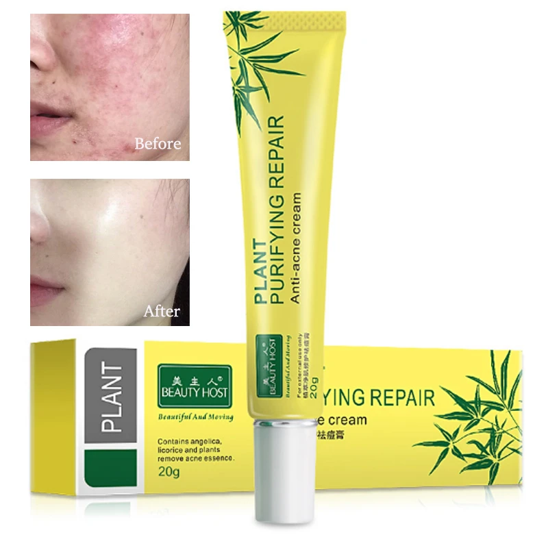 stevia acne cream