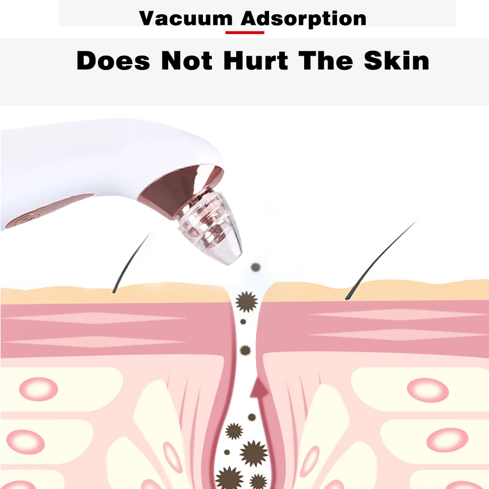 Face Nose Acne Black Dot Remover пылесос для чистки пор Сменный наконечник Электрический пылесос Инструменты для ухода за кожей Машина