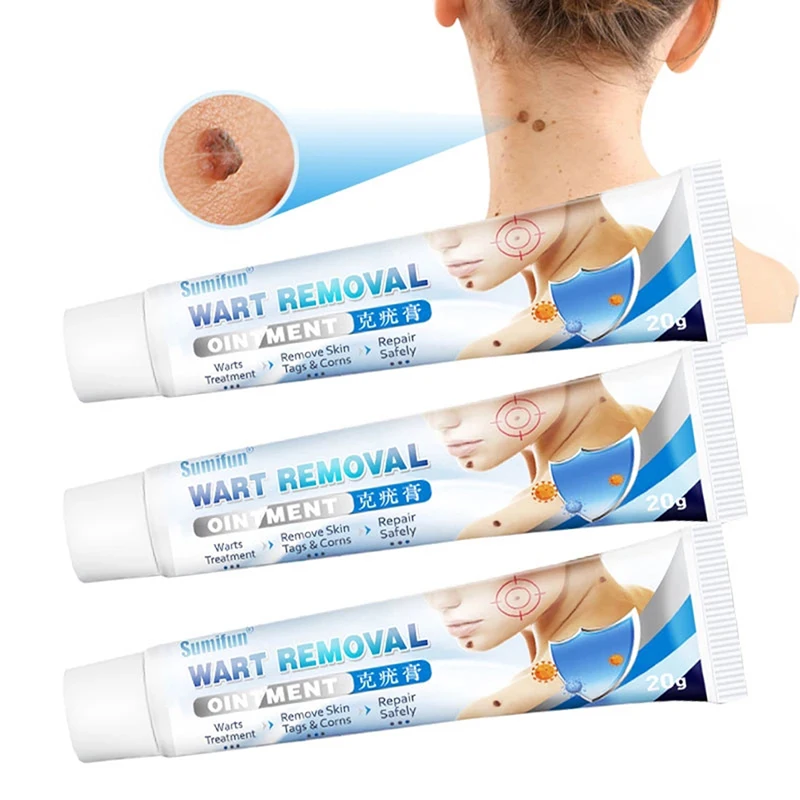 dronken eetpatroon Hol Wratten Remover Antibacteriële Zalf Kruiden Wart Behandeling Crème Skintag  Remover Kruiden Extract Maïs Gips Wratten Zalf|null| - AliExpress